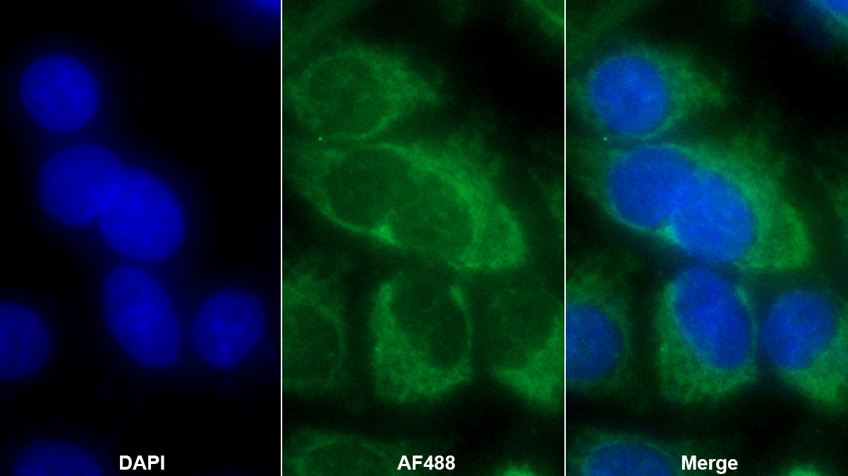 Polyclonal Antibody to Virus Induced Signaling Adapter (VISA)