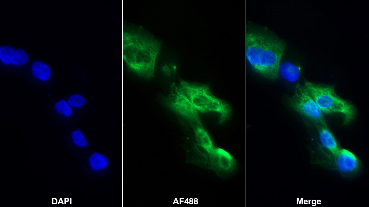 Polyclonal Antibody to Vanin 1 (VNN1)