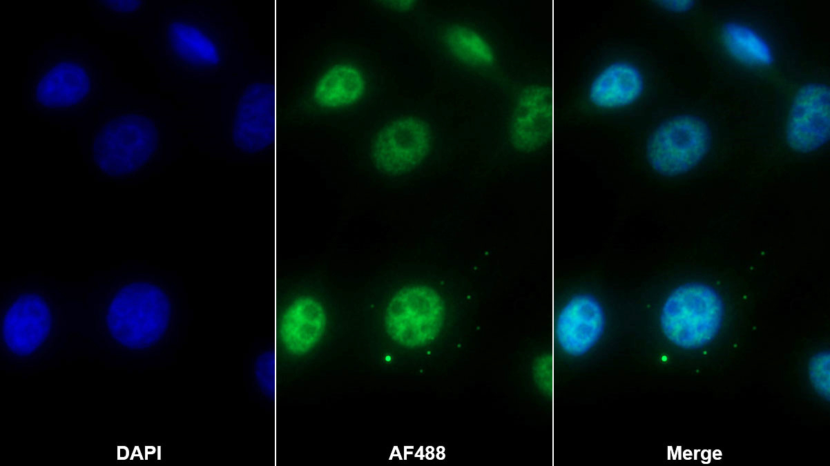 Polyclonal Antibody to YY1 Associated Factor 2 (YAF2)