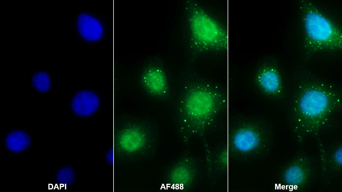 Polyclonal Antibody to YY1 Associated Factor 2 (YAF2)