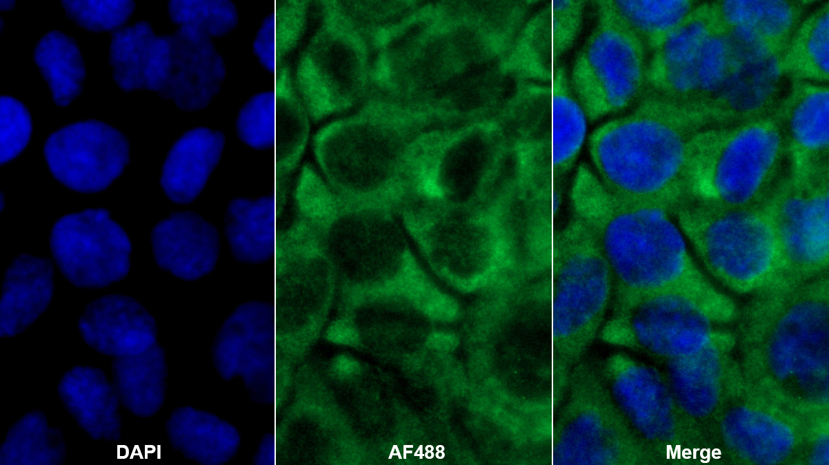 Polyclonal Antibody to Zuotin Related Factor 1 (ZRF1)