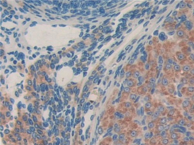 Polyclonal Antibody to Metastasis Associated Protein 1 (MTA1)
