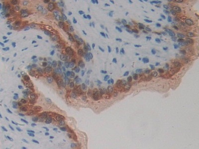 Polyclonal Antibody to Metastasis Associated Protein 1 (MTA1)