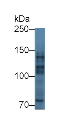 Polyclonal Antibody to Myelin Transcription Factor 1 (MYT1)