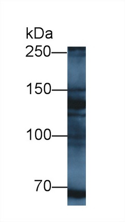 Polyclonal Antibody to Myelin Transcription Factor 1 (MYT1)