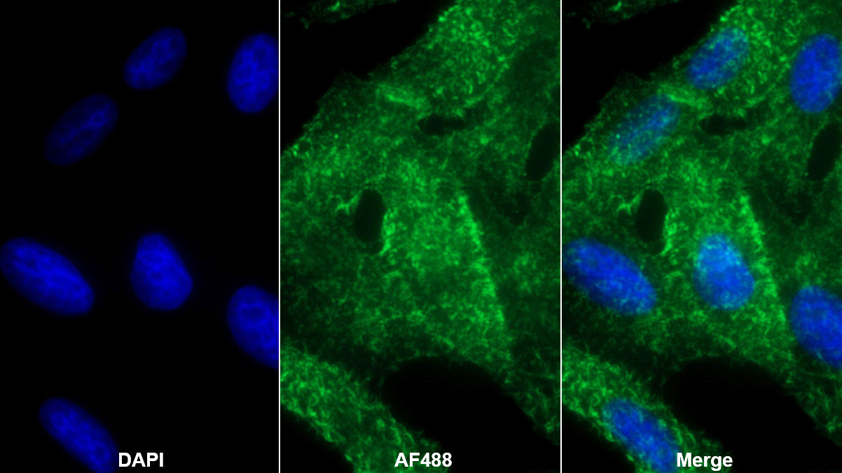 Polyclonal Antibody to Moesin (MSN)