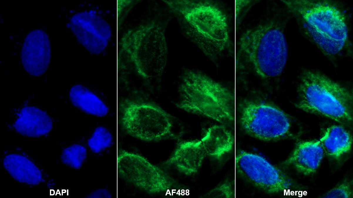 Polyclonal Antibody to Insulin Like Growth Factor Binding Protein 5 (IGFBP5)