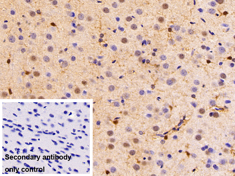 Polyclonal Antibody to Neuron Derived Orphan Receptor 1 (NOR1)