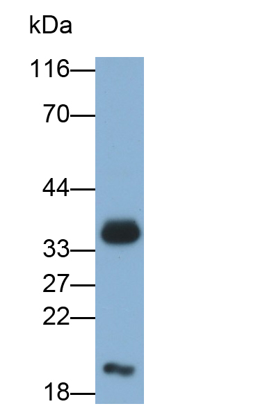 Polyclonal Antibody to Oxoguanine Glycosylase 1 (OGG1)