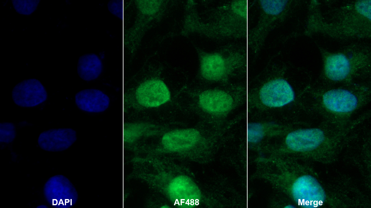 Polyclonal Antibody to Polymerase DNA Directed Delta 1 (POLd)