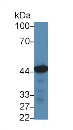 Polyclonal Antibody to Pyruvate Dehydrogenase Kinase Isozyme 1 (PDK1)