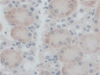 Polyclonal Antibody to Peroxisomal Biogenesis Factor 1 (PEX1)