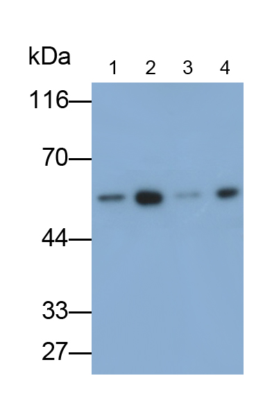 Polyclonal Antibody to Phospholipid Transfer Protein (PLTP)