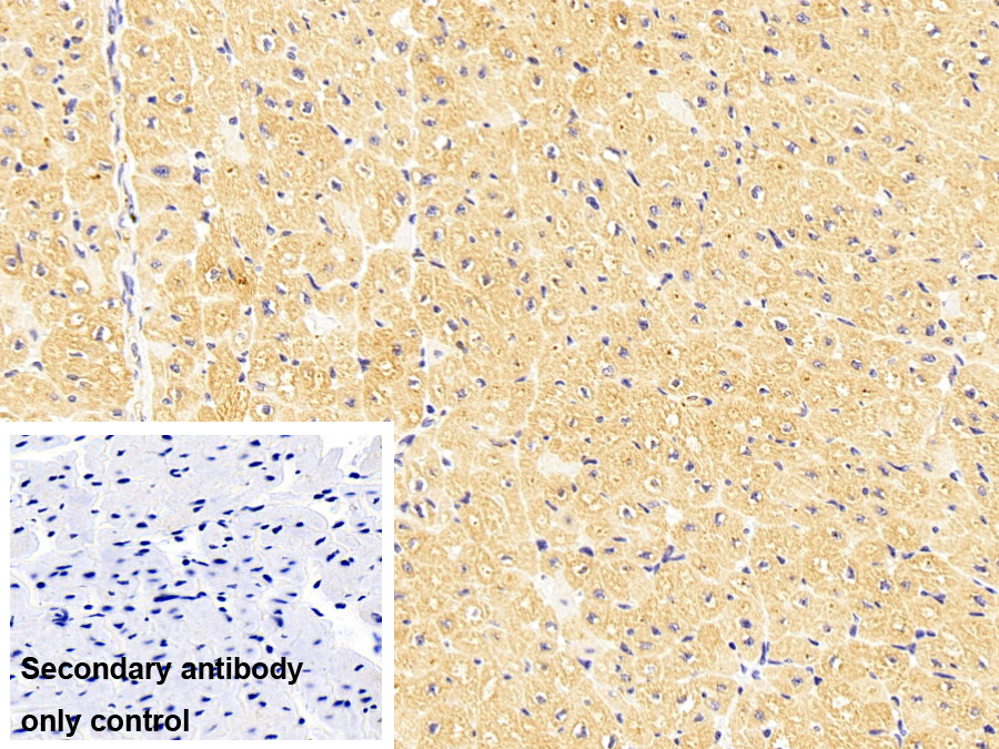 Polyclonal Antibody to Prosaposin (PSAP)