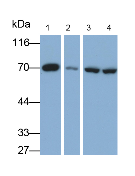 Polyclonal Antibody to Ribophorin I (RPN1)