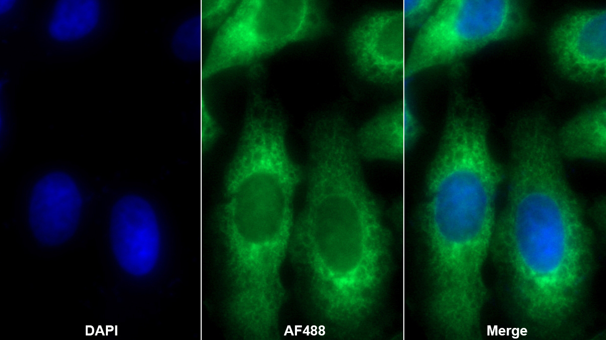 Polyclonal Antibody to Ribosome Binding Protein 1 (RRBP1)