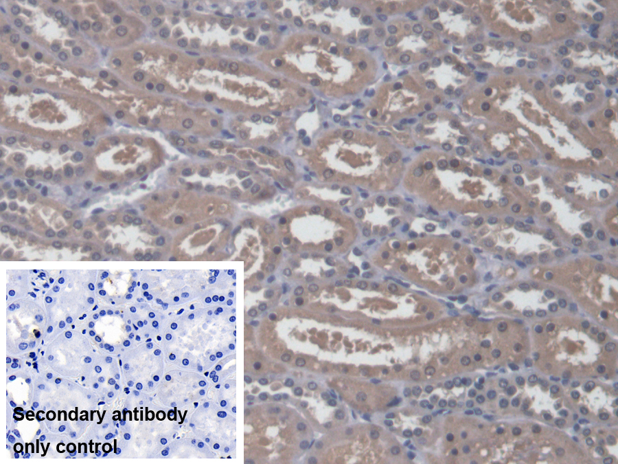 Polyclonal Antibody to Radixin (RDX)