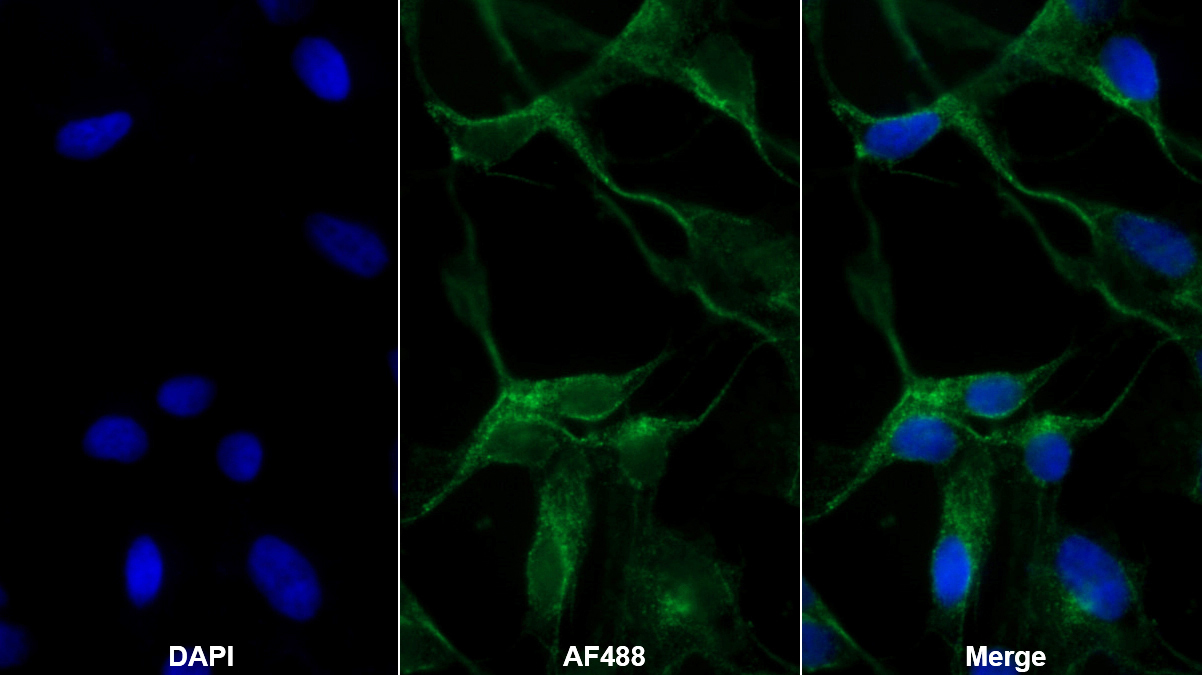 Polyclonal Antibody to Reelin (RELN)