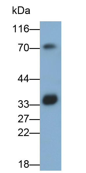 Polyclonal Antibody to Rhodopsin (RHO)
