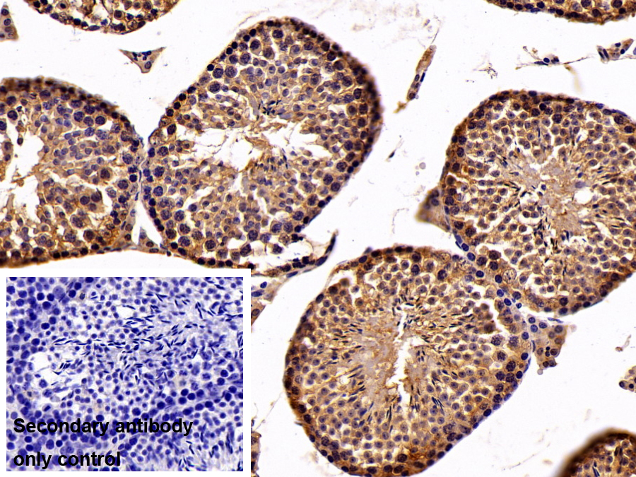 Polyclonal Antibody to Tubulin Folding Cofactor A (TBCA)