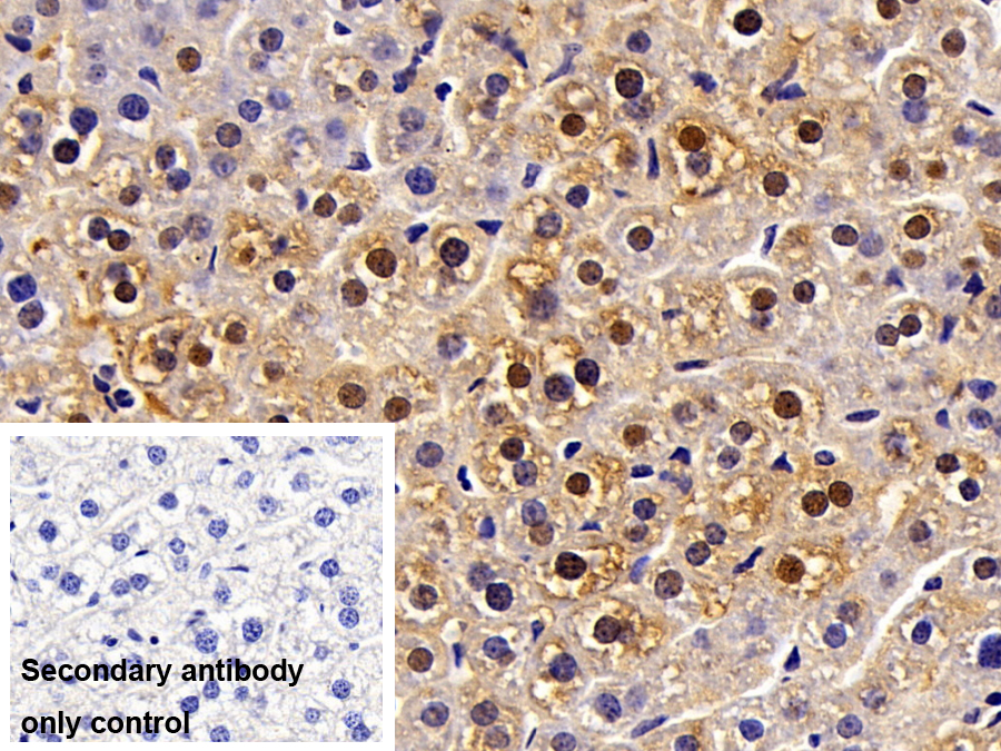 Polyclonal Antibody to Tubulin Folding Cofactor A (TBCA)