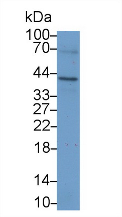 Polyclonal Antibody to Spermine Synthase (SMS)