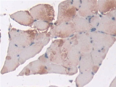 Polyclonal Antibody to Sorting Nexin Associated Golgi Protein 1 (SNAG1)