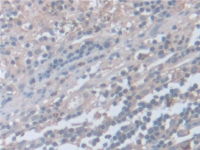 Polyclonal Antibody to Synaptosomal Associated Protein 23kDa (SNAP23)