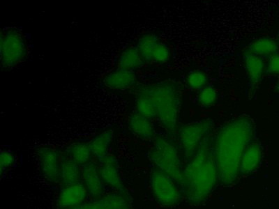 Polyclonal Antibody to Synaptosomal Associated Protein 23kDa (SNAP23)