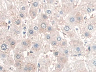 Polyclonal Antibody to Sperm Associated Antigen 1 (SPAG1)
