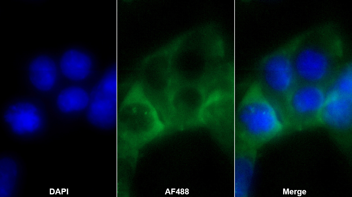 Polyclonal Antibody to Sterol Regulatory Element Binding Transcription Factor 1 (SREBF1)