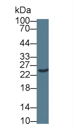 Polyclonal Antibody to Signal Recognition Particle Receptor B (SRPRB)