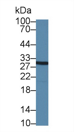 Polyclonal Antibody to Signal Recognition Particle Receptor B (SRPRB)
