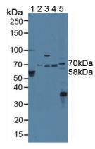 Polyclonal Antibody to Signal Transducing Adaptor Molecule 2 (STAM2)