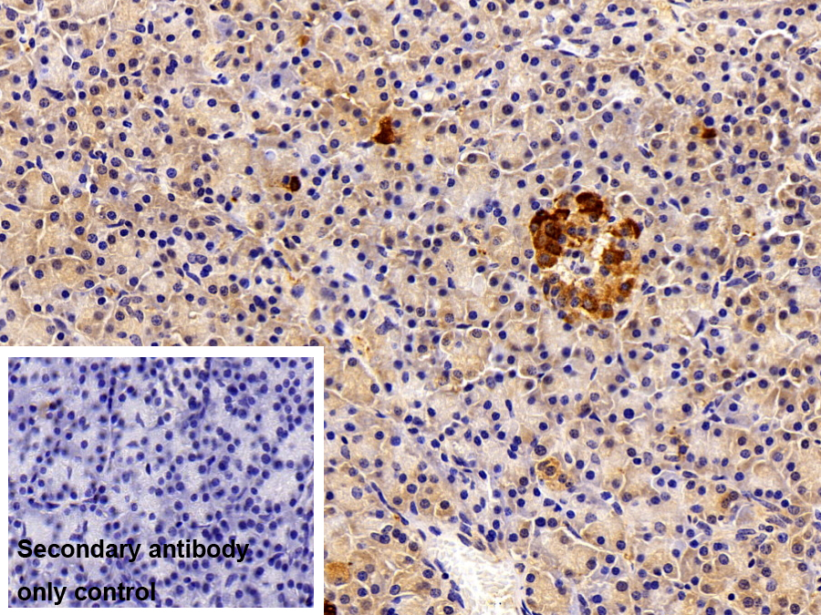 Polyclonal Antibody to Chromogranin B (CHGB)