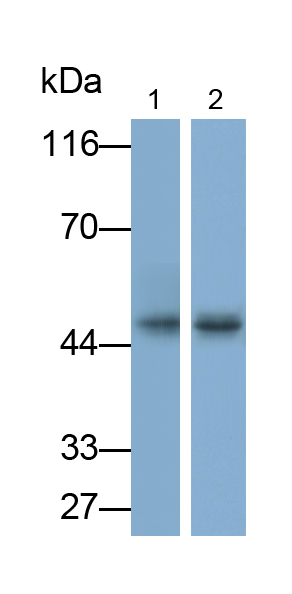 Polyclonal Antibody to Deiodinase, Iodothyronine, Type II (DIO2)