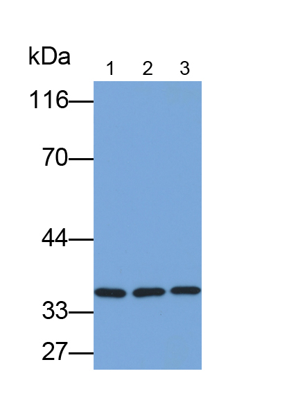 Polyclonal Antibody to Deiodinase, Iodothyronine, Type II (DIO2)