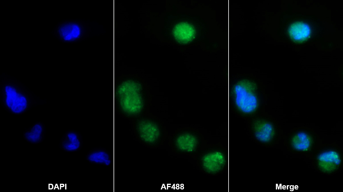 Polyclonal Antibody to Fibroblast Growth Factor 13 (FGF13)