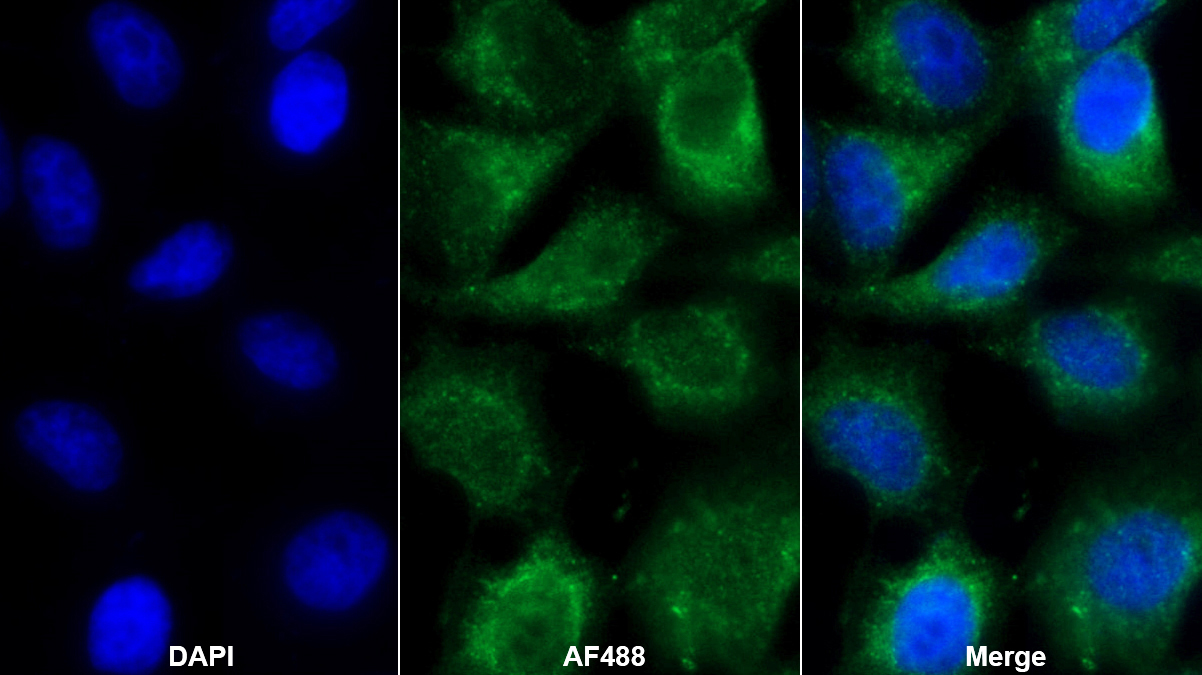 Polyclonal Antibody to Platelet Derived Growth Factor Subunit B (PDGFB)