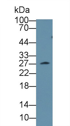 Polyclonal Antibody to Clathrin, Light Polypeptide A (CLTA)