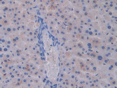 Polyclonal Antibody to Cathepsin C (CTSC)
