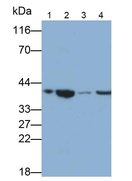 Polyclonal Antibody to Carcinoembryonic Antigen Related Cell Adhesion Molecule 8 (CEACAM8)