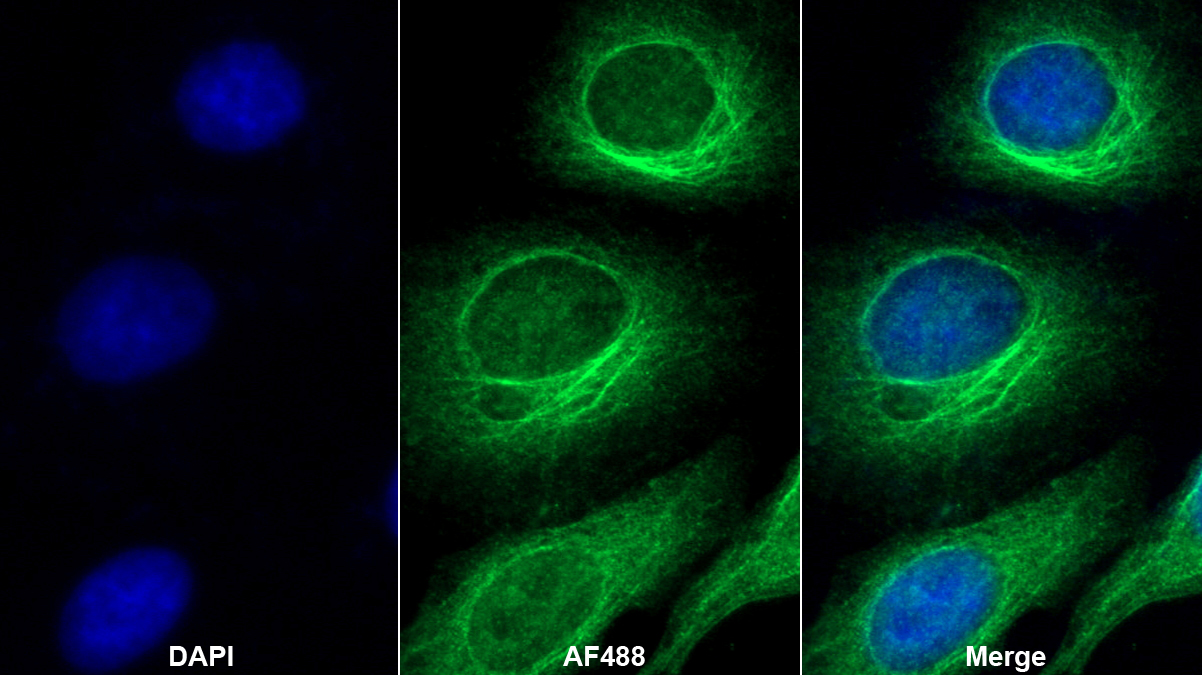 Polyclonal Antibody to Glutathione Peroxidase 4 (GPX4)