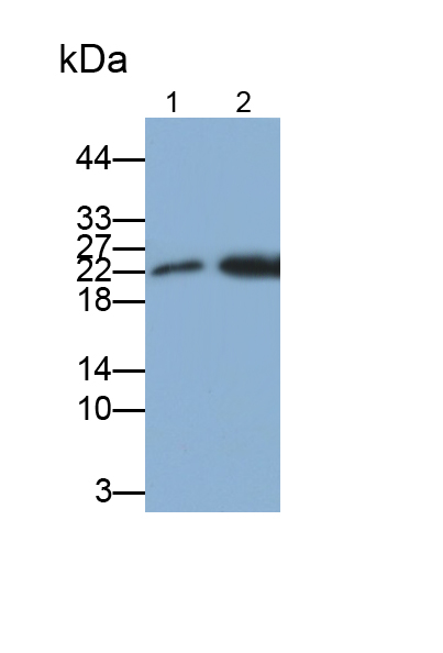 Polyclonal Antibody to Ferritin, Light Polypeptide (FTL)