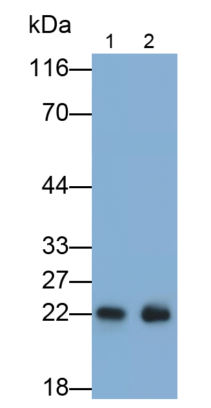 Polyclonal Antibody to Ferritin, Heavy Polypeptide (FTH)