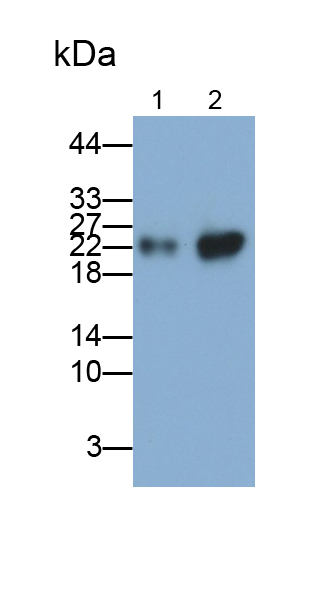 Polyclonal Antibody to Ferritin, Heavy Polypeptide (FTH)