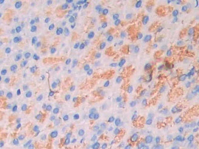 Polyclonal Antibody to Carbonic Anhydrase VII (CA7)
