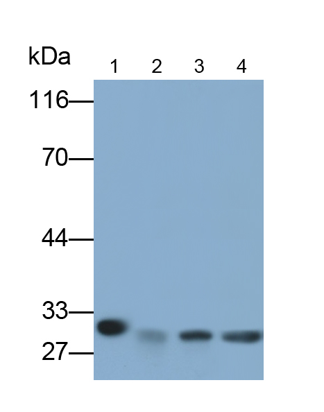 Polyclonal Antibody to Carbonic Anhydrase VA (CA5A)
