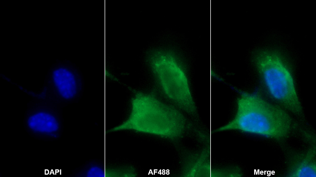 Polyclonal Antibody to Carbonic Anhydrase VA (CA5A)