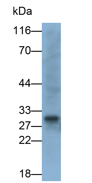 Polyclonal Antibody to Carbonic Anhydrase VA (CA5A)